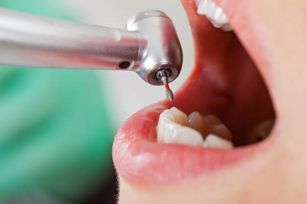 Best Emergency Cosmetic Dentistry in Terra Bella, CA